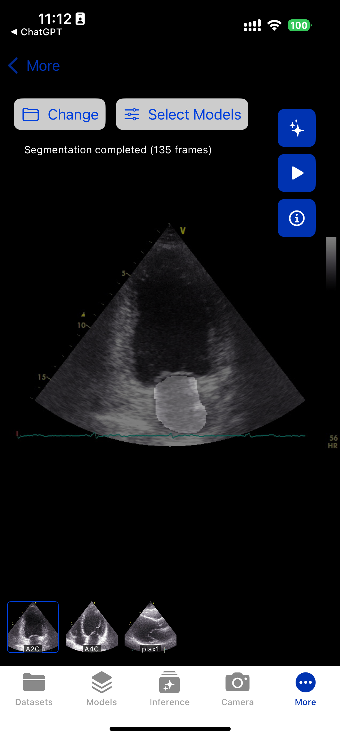 DICOM medical imaging viewer with segmentation